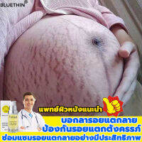 BLUETHINครีมทาแตกลายครีมทาขาแตกลายครีมทาขาลาย ครีมทาผิวครีมครีมทารอยแตกลดผิวแตกลายแก้แตกลายครีมลดลอยแตกลาย ครีมทาแผลเป็น ครีมแก้แตกลาย ครีมลบรอยแตกลาย ครีมซ่อมแซม ยาลบลอยแผลเป็น ครีมท้องลาย ครีมรอยแตกลดผิวแตกลาย ครีมทาผิแตกScarRemovalCream