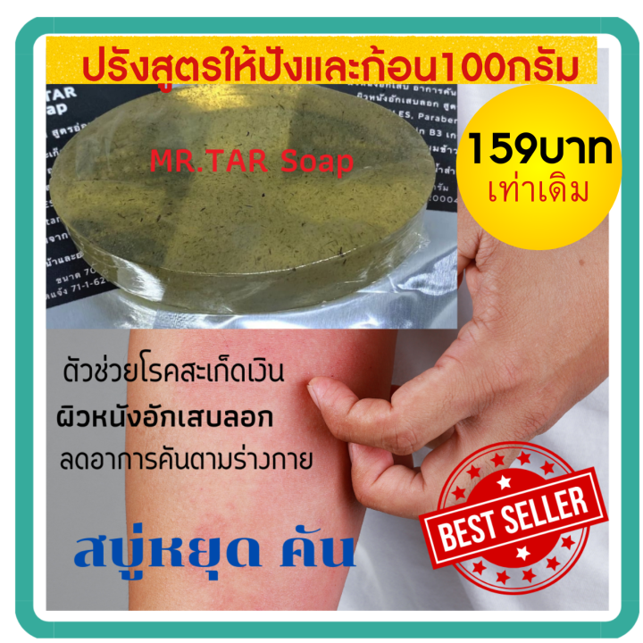 สบู่น้ำมันดิน-mr-tar-soap-100-กรัม-สะเก็ดเงิน-เซบเดิร์ม-ผิวหนังอักเสบ-ผื่นคัน-ผิวหนังอักเสบ-ส่งด่วน