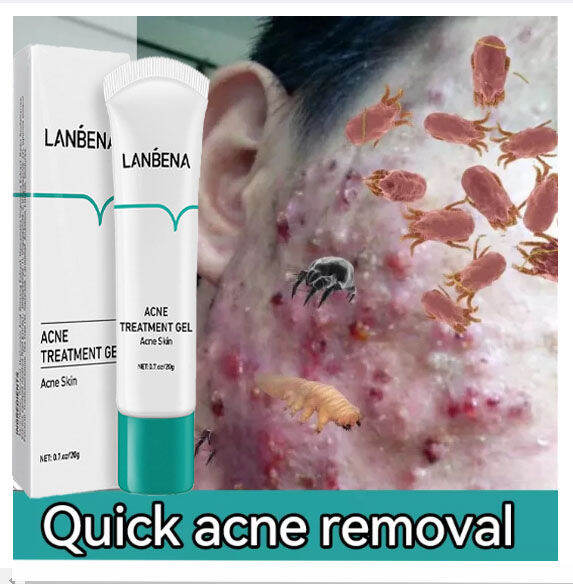 how to get rid of acne scar serum - TikTok Shop