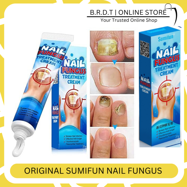 Effective Anti-Fungal | SUMIFUN Nail Fungus Treatment Cream | Nail ...