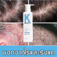 [ขายดี]?ทำความสะอาดผม แชมพู OUSHILIAN shampoo ป้องกันผมร่วง ขจัดรังแค แข็งแรง สดชื่นควบคุมความมัน แชมพูขจัดรังแค เชื้อราบนศีรษะ แชมพู แก้ผมเสีย ไม่มีรังแค สบายมาก สระผมแก้เชื้อรา ซ่อมแซมผมเสีย ป้องกันรังแคแชมพูแก้ผมร่วง