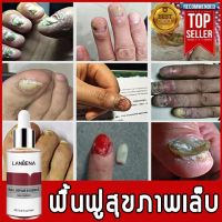 ★พร้อมส่ง★ สาระสําคัญของเล็บLANBENA รักษาเชื้อราเล็บ รักษาเล็บ เซรั่มบำรุงเล็บ ฆ่าเชื้อราที่เล็บ รักษารคเชื้อราที่เล็บ