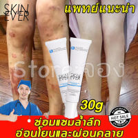 SKINEVER ครีมทาแผลเป็น 30g #เจลลบแผลเป็น ยับยั้งแผลเป็นเพิ่มใหม เร่งการซ่อมแซมให้ผิว เจลลบรอยแผลเป็น