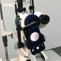 Iphone Slit Lamp Operating Microscope Camera Adapter