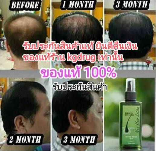 neohair-hair-growth-serum-genuine-from-the-factory