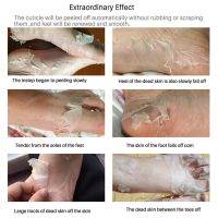 หน้ากากเท้า EFERO Exfoliating Foot