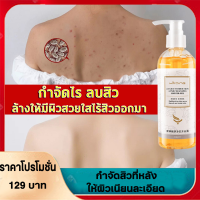 HYQING ครีมอาบน้ำ 260ml กำจัดไร ลบสิว ครีมอาบน้ำหอมๆ  ให้ผิวเนียนนุ่ม