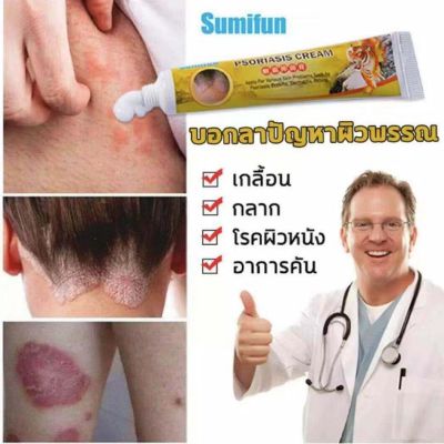 Sumifun ยารักษาเชื้อรา ยาทาแก้ผื่นคัน ยารักษาเกลื้อน โรคผิวหนัง