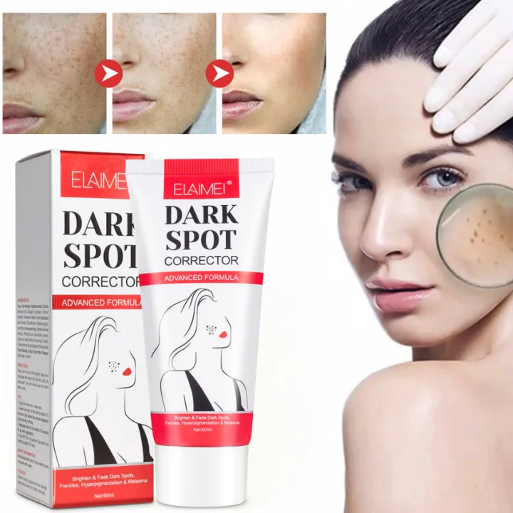 ELAIMEI Dark Spot Corrector Cream Whitening Freckle Cream Powerful