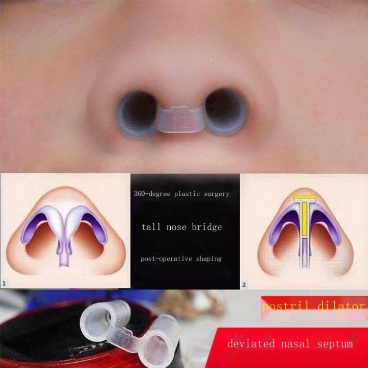 Comprehensive edges postoperative nasal shape support nostril nose ...