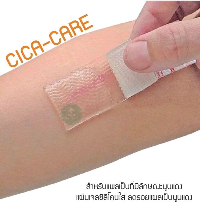 cica-care-silicone-gel-sheet-แผ่นเจลซิลิโคน-แบบใส-ลดรอยแผลคีลอยด์-แผลผ่าตัด-แผลผ่าคลอด-แผลนูน