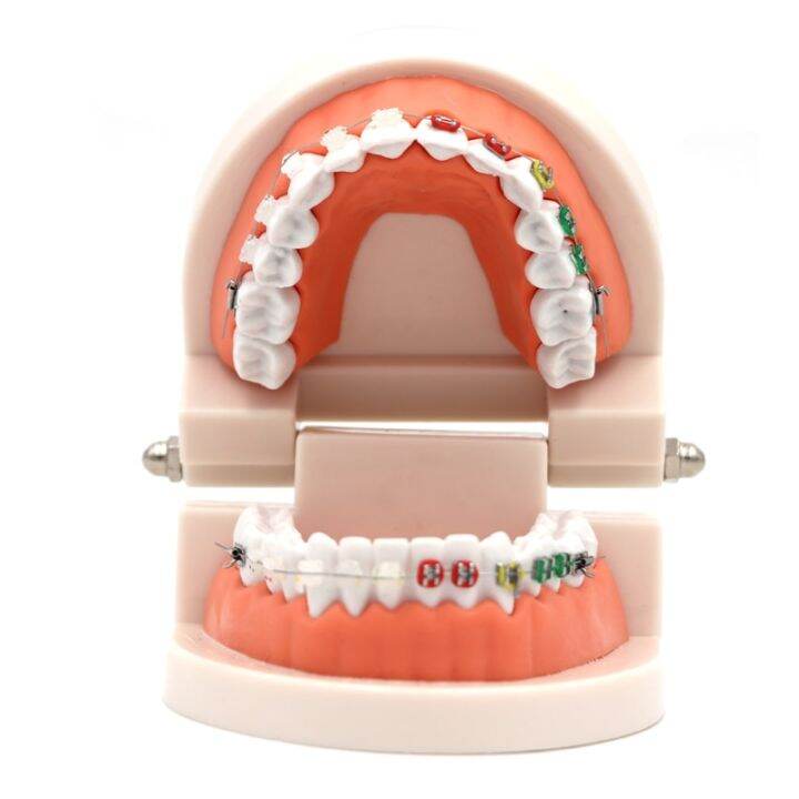 Dental Orthodontic Treatment Model Typodont With Ortho Metal Ceramic