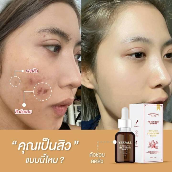 ล็อตใหม่พร้อมส่ง-เซรั่มสตอ-เซรั่มสตอเบอรี่-yerpall-ล็อตใหม่ล่าสุด-yerpall-เซรั่มสตอ-พร้อมส่ง-แท้-1ขวด