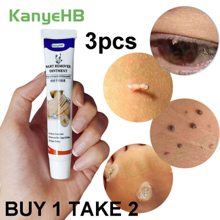 Warts Removal Ointment Original Wart Cream Plantar Warts Skin Tag