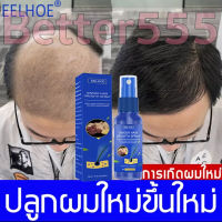 EELHOE สเปรย์เร่งผมยาว30ml สเปรย์ปลูกผมใหม่ สเปรย์ปลูกผม ยาปลูกผมผู้ชาย ปรับปรุงคุณภาพของเส้นผม เร่งผมงอกใหม่(น้ำยาปลูกผม,เซรั่มปลูกผม,น้ำยาใส่ผม,น้ำยาเร่งผมยาว) Hair Growth