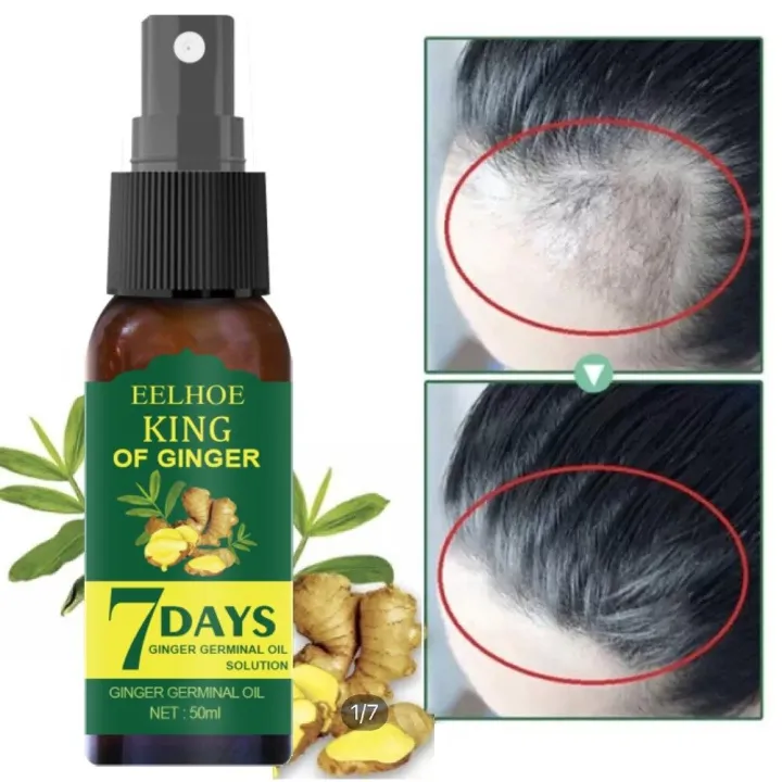 Apphom Eelhoe 50ml Hair Loss Treatment, Ginger Hair Growth Serum Hair Care  Hair Growth Serum Hair