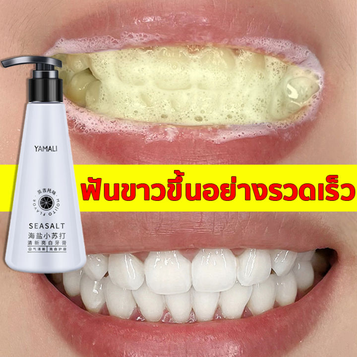 เห็นผลใน7วัน-ยาสีฟันฟันขาว-200g-ยาสีฟันเกลือทะเล-ฟอกฟันขาว-ยาสีฟันลดกลิ่น-คราบชากาแฟ-ยาสีฟันหินปูน-ฟอกฟันขาวแท้-กำจัดกลิ่นปาก-เสียวฟัน-ยาสีฟันโปรไบโอติก