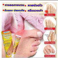 เห็นผลไว Bunion cream ลดปวด ลดอักเสบ นิ้วโป้งโค้งงอเข้า Hallux valgus ปวดเท้า ปวดข้อ ปวดบวม ข้ออักเสบ ข้อบวม ข้อต่อนิ้วเท้า บรรเทาอาการ บรรเทาปวด ค