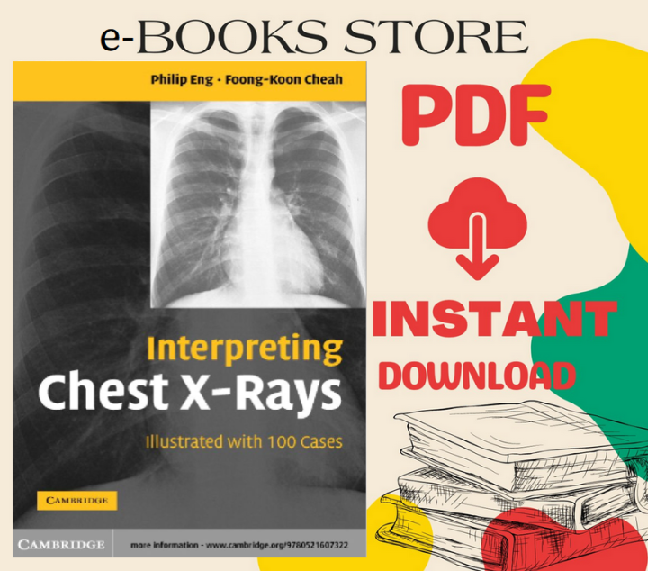 interpreting chest x-rays illustrated with 100 cases pdf free download