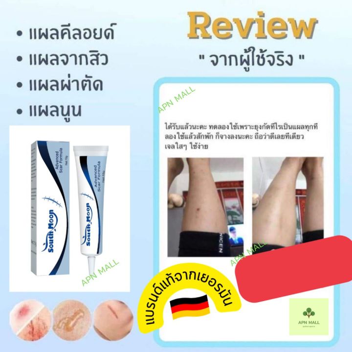 ของแท้จากเยอรมัน-พร้อมส่ง-ครีมลดรอยแผลเป็น-ลดรอยแผลเป็น-รอยสิว-ลบรอยแผลเป็น-สำหรับรอยสิว-แผลเผาไหม้-แผลเป็นจากการผ่าตัด