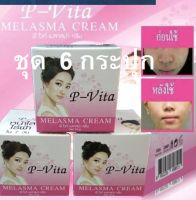 (ส่ง 6 ชุด) P-vita พีวิตตา เมลาสม่า 10 กรัม*6 ชุด ครีมบำรุงผิวหน้า ลดฝ้าแดด กระ จุดด่างดำ