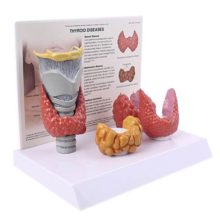 KH66ZKY Thyroid Anatomy Model - Thyroid Nodule Model - For Science Classroom Study Display Thyroiditis Mastoid Cancer Teaching Medical Model