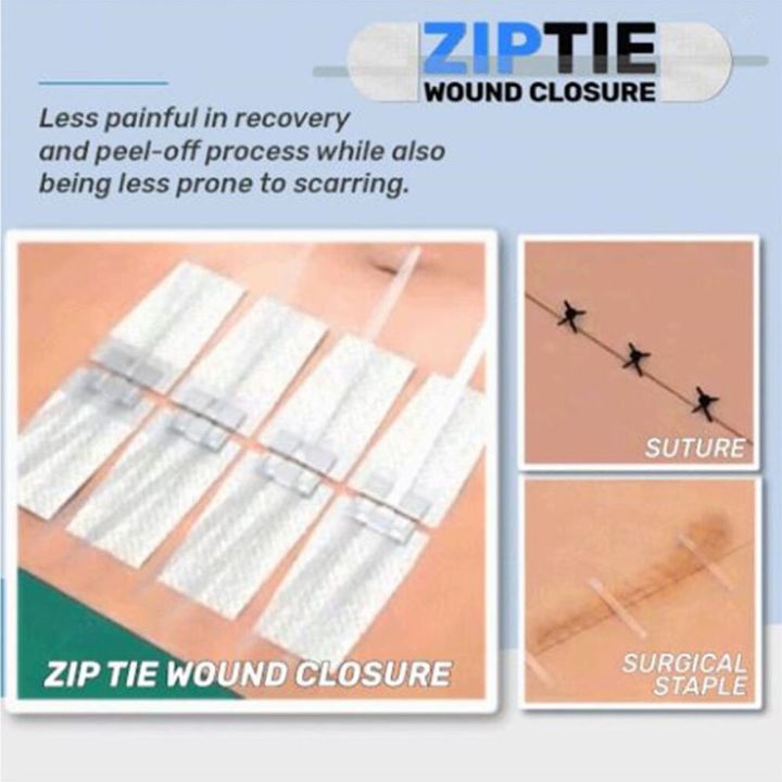 3pcs-disposable-zip-tie-wound-closure-patch-hemostatic-adhesive-aid-emergency-kit-laceration-band-aid-without-stitches