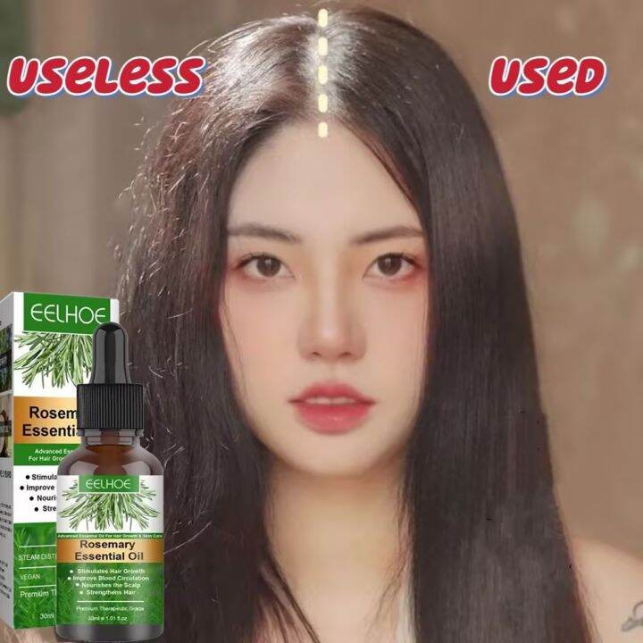 Rosemary Hair Growth Essential Oil Repair Damaged Frizzy Thinning Scalp