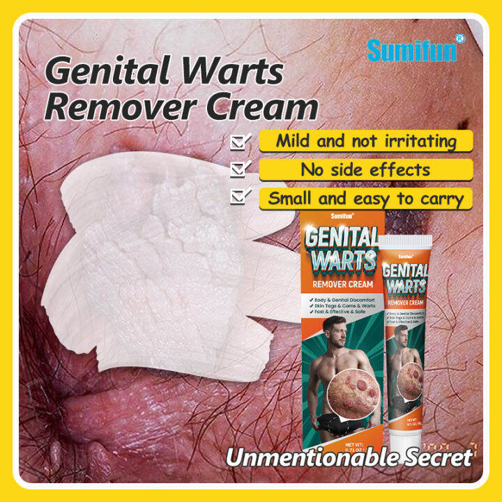 Clinically Proven Formula Effectively Genital Warts Treatment Warts ...