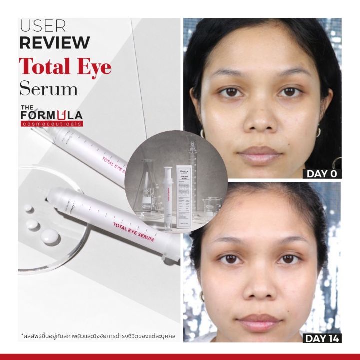 สินค้าขายดีมาก-the-formula-total-eye-serum-10-ml-ครีมทารอบดวงตา-ครีมทาใต้ตา-ลดตาคล้ำถุงใต้ตาและริ้วรอยรอบดวงตา