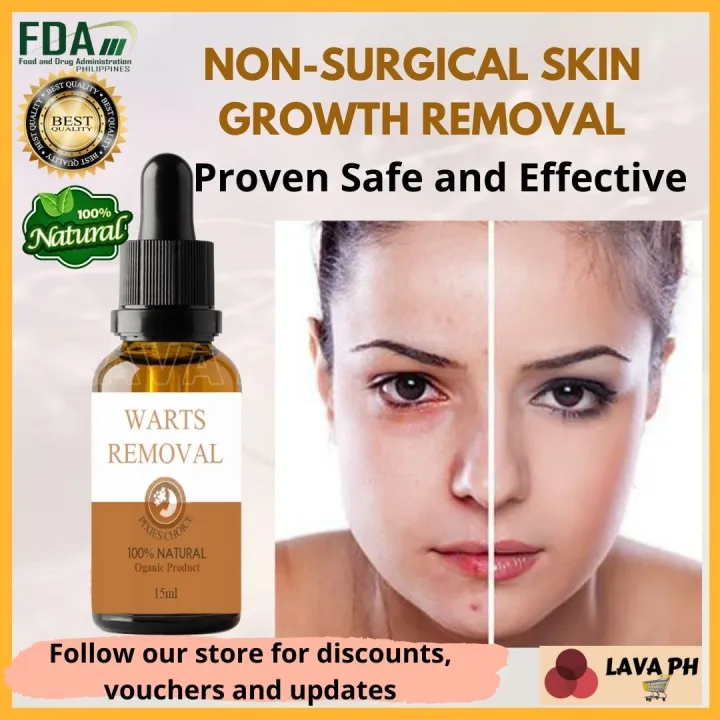 LAVA PH Authentic 100 Natural Pure Organic Kasoy Oil + Salicylic Acid