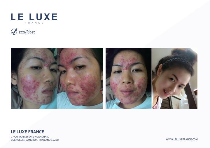 le-luxe-france-absolute-revitalizing-natural-skin-5g-12-ซอง-ครีมมาส์กหน้า-แอ๊บโซลูท-แก้ปัญหา-ฝ้า-กระ-ผิวแห้ง-หน้าโทรม