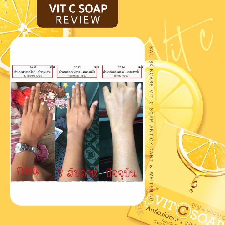 vit-c-soap-10-ก้อน-สบู่ผิวกาย-สบู่โสมเกาหลี-สบู่วิตซี-เพื่อผิวขาว-สิวหลัง-ผลัดขี้ไคล-กลิ่นกาย-เชื้อรา-ปัญหาผิวหนัง-ใช้ได้ทั้งชายหญิง