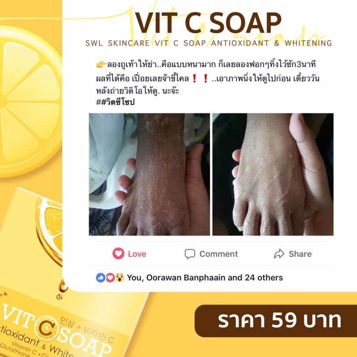 vit-c-soap-10-ก้อน-สบู่ผิวกาย-สบู่โสมเกาหลี-สบู่วิตซี-เพื่อผิวขาว-สิวหลัง-ผลัดขี้ไคล-กลิ่นกาย-เชื้อรา-ปัญหาผิวหนัง-ใช้ได้ทั้งชายหญิง