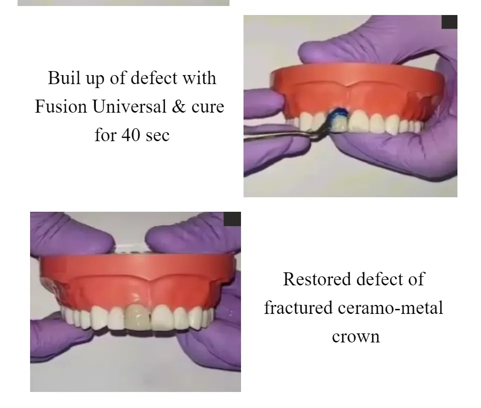 ACE (Ceramic Repair Kit), PREVEST DENPRO Dental