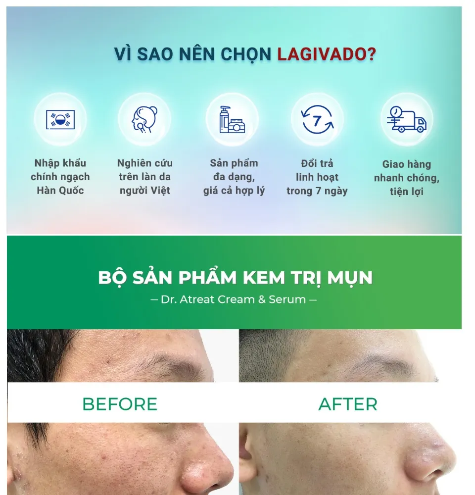 Bộ ba kem dưỡng ngăn ngừa mụn, giảm mụn viêm Lagivado Atreat Cream ...