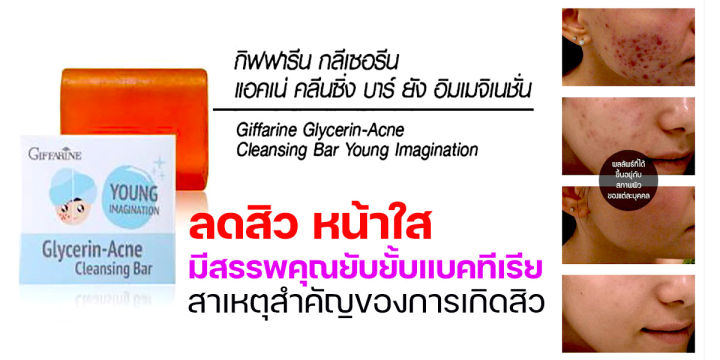 สบู่ล้างหน้า-วัยรุ่น-แอคเน่-คลีนซิ่ง-บาร์-กิฟฟารีน-สบู่กลีเซอรีน-ผิวหน้าชุ่มชื้น-ไม่แห้งตึง