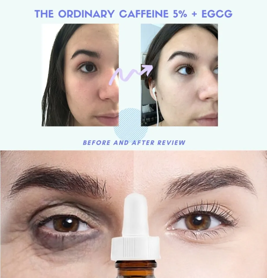 Discover more than 120 the ordinary for eye bags super hot