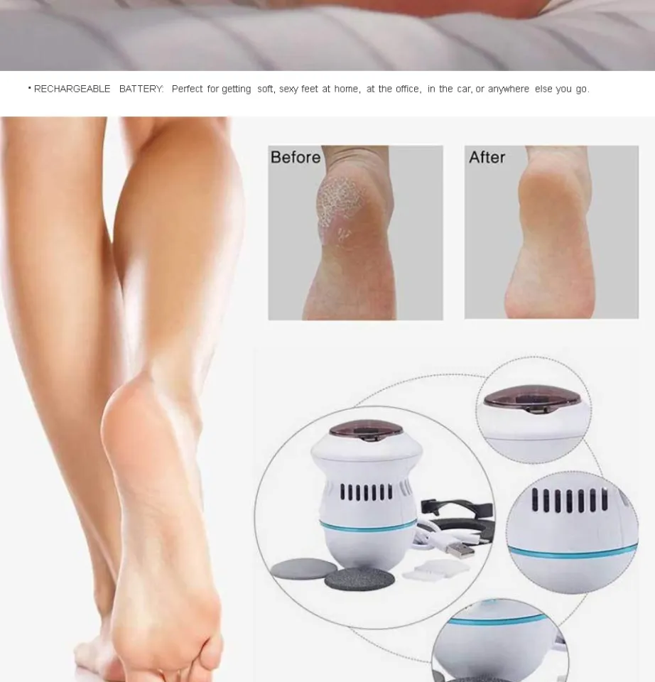 Pedi Vac by PedEgg Foot File and Callus Remover with Built-In Vacuum:  Rechargeable Motorized Electric Callus Remo…