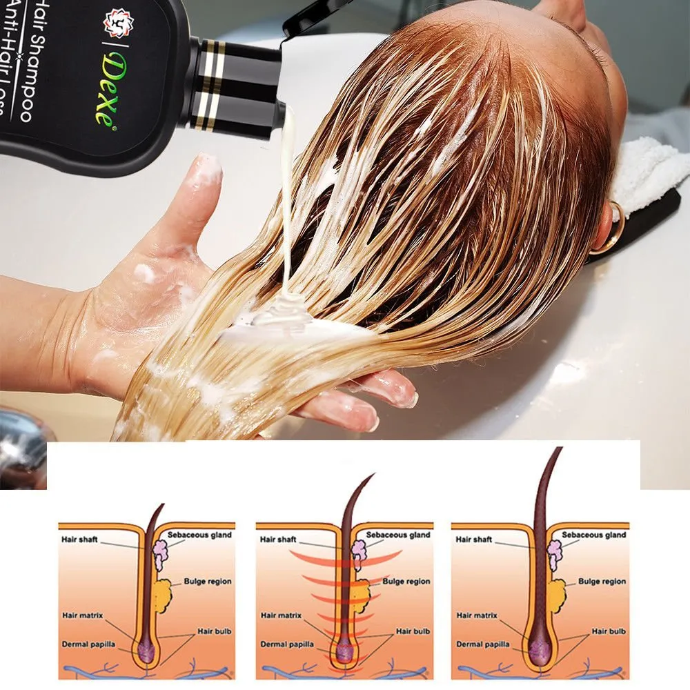 DEXE Anti Hair Loss Shampoo With Advance Formula 200ml, Hair Growth Stimulating Shampoo For All Types Of Hair, Anti Hair Fall and Hair Grower Shampoo Faralex Thinning Hair Treatment for Anti Hairloss DEXE Anti Hair Loss Shampoo With Advance Formula 200ml, Hair Growth Stimulating Shampoo For All Types Of Hair, Anti Hair Fall and Hair Grower Shampoo Faralex Thinning Hair Treatment for Anti Hairloss