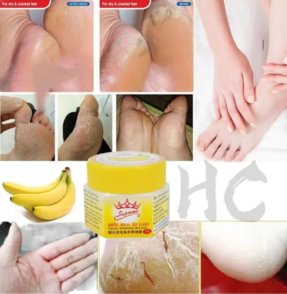 20g foot Dead Skin Remover banana oil Anti-drying crack foot cream cracked  heel repair hand