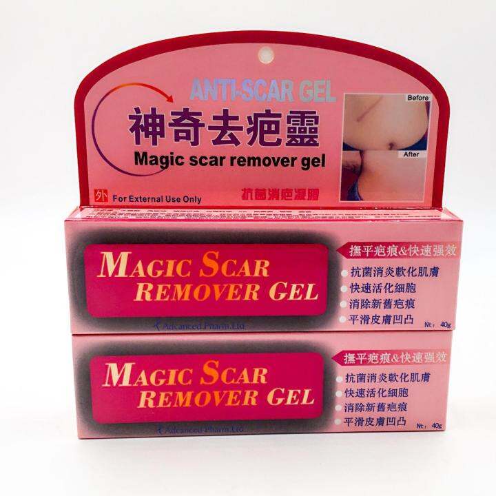 Magic Scar Remover Gel 40g Set Of 2 Tubes Lazada Ph