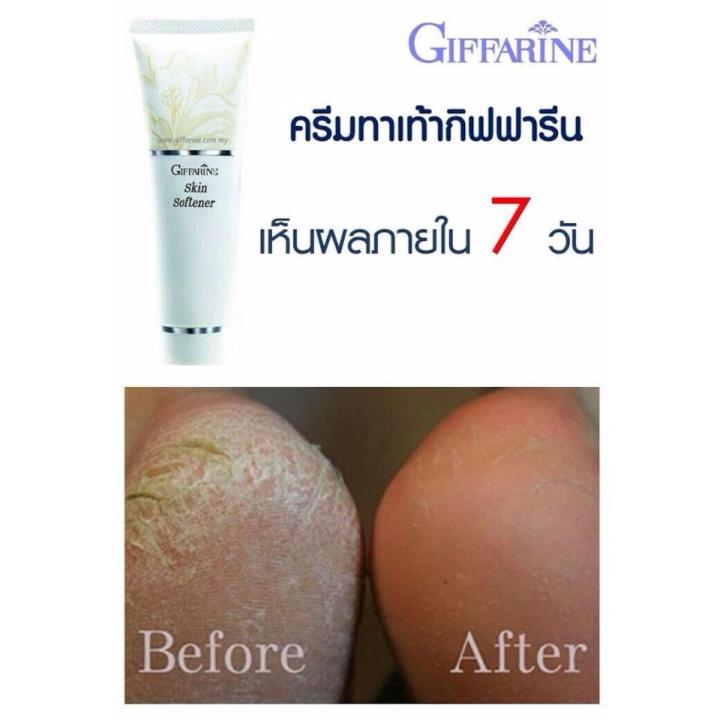 giffarine-skin-softener-ครีมรักษาส้นเท้าแตก-รักษาข้อศอกด้าน-เพิ่มความชุ่มชื้นแก่ผิว-บริเวณที่แห้ง-หรือ-หยาบกร้าน-1-ชิ้น